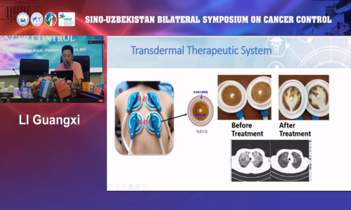 李光熙教授携TTS®科技参加中国——乌兹别克斯坦癌症防治双边研讨会