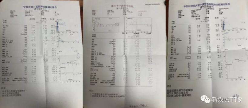 寒潮来袭 河南一呼吸科门诊超千人 紧急提醒 天气多变 这几病必定高发